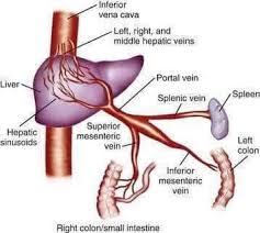 Hội chứng Banti - Hình ảnh minh họa